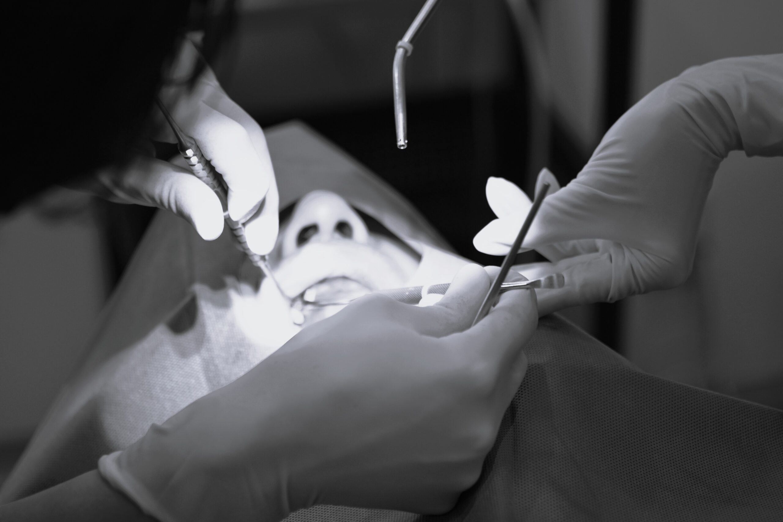 右上4番インプラント一次埋入オペ　＃076 画像