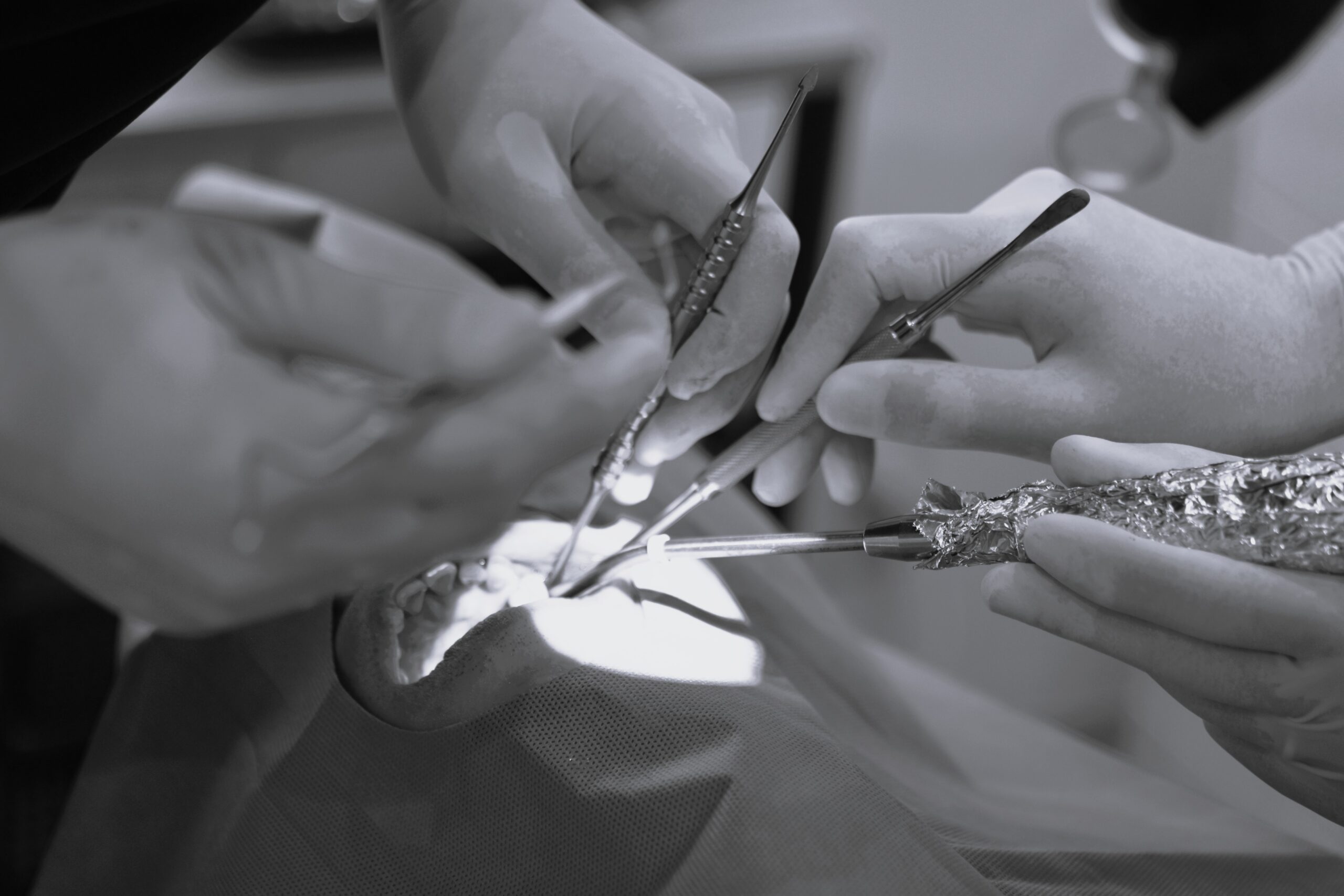 ソケットリフト・１次埋入オペ　＃074 画像