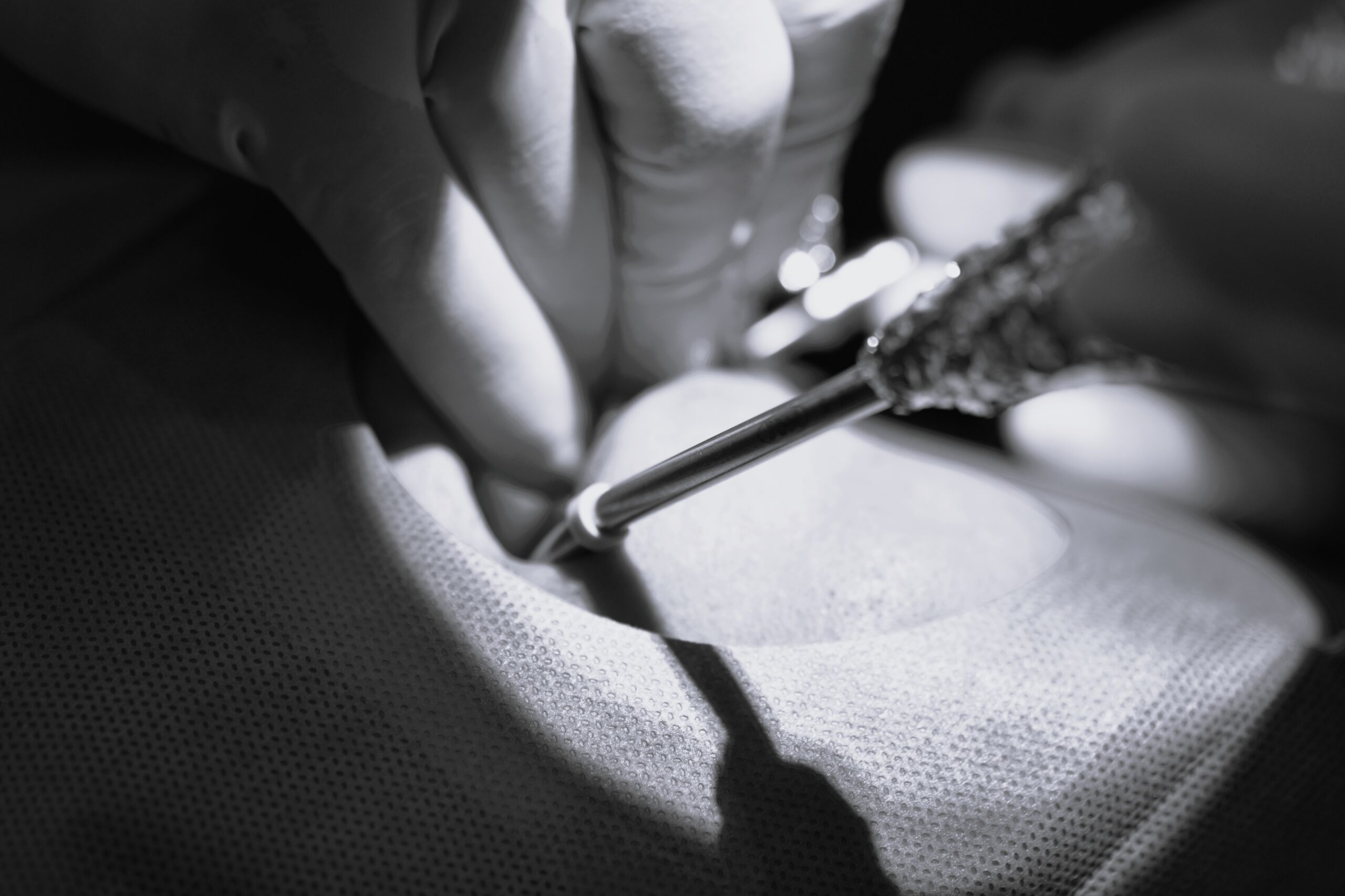 左上5番インプラント一次埋入オペ　＃078 画像