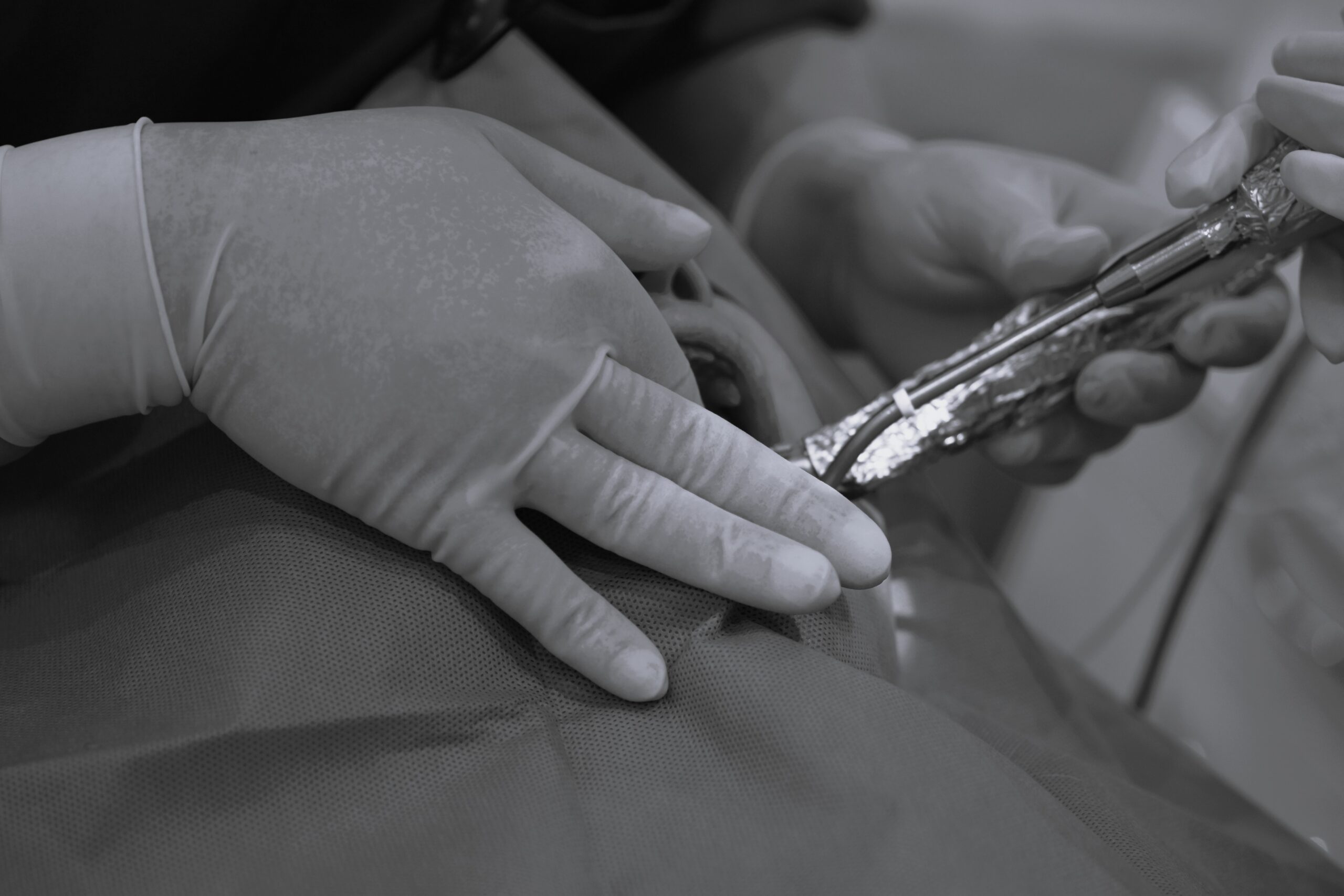 右下５番、左下６番インプラント一次埋入オペ　＃079 画像