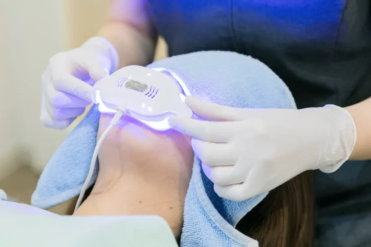 オフィスホワイトニング