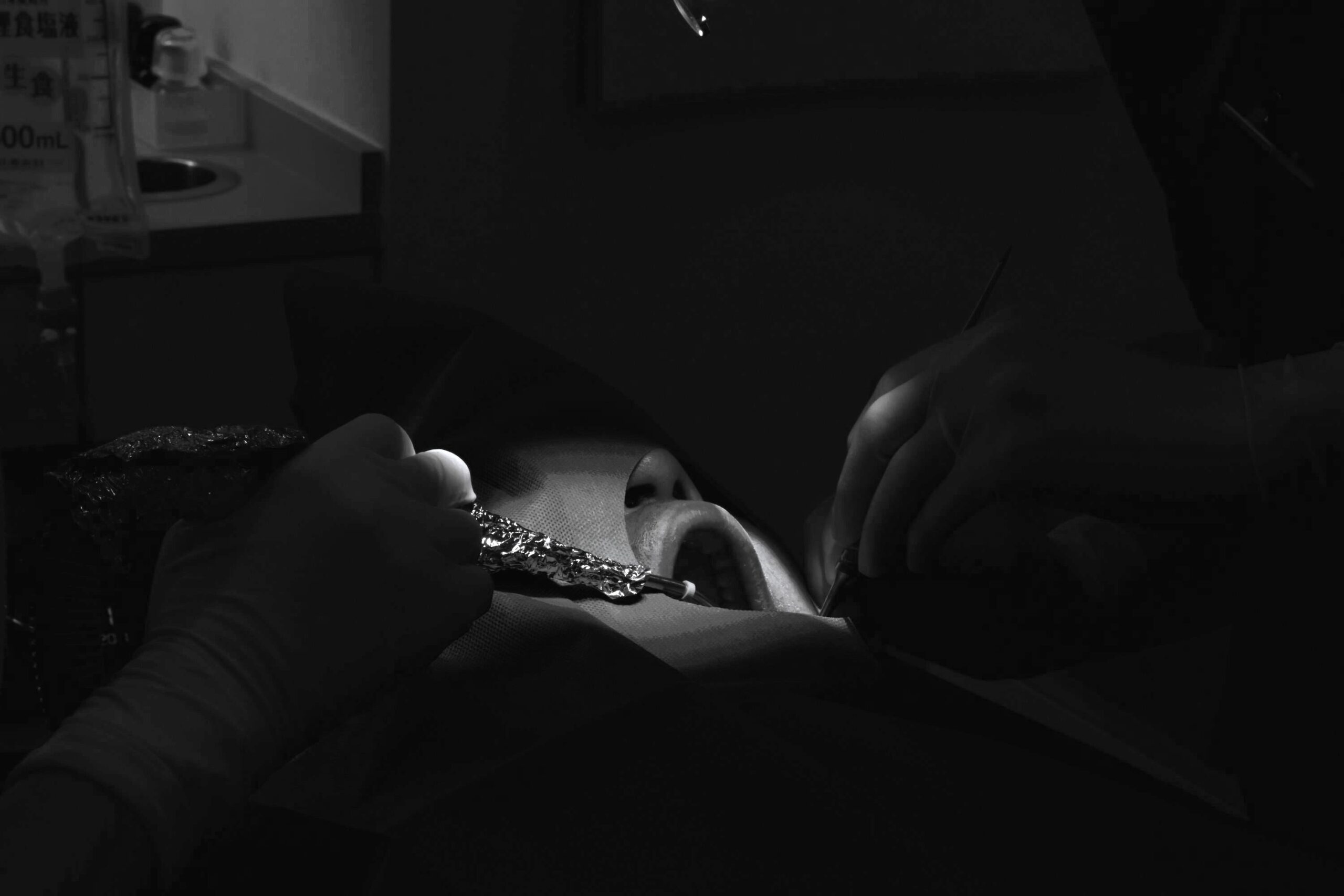 左下６番インプラント一次埋入オペ ＃097 画像