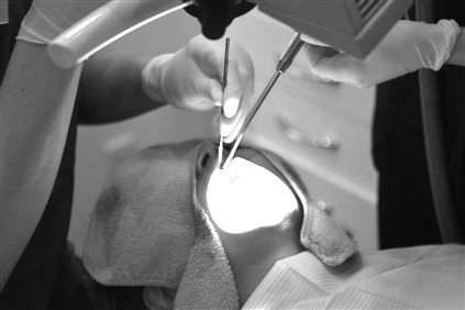 歯根端切除術　右上１番　＃102 画像